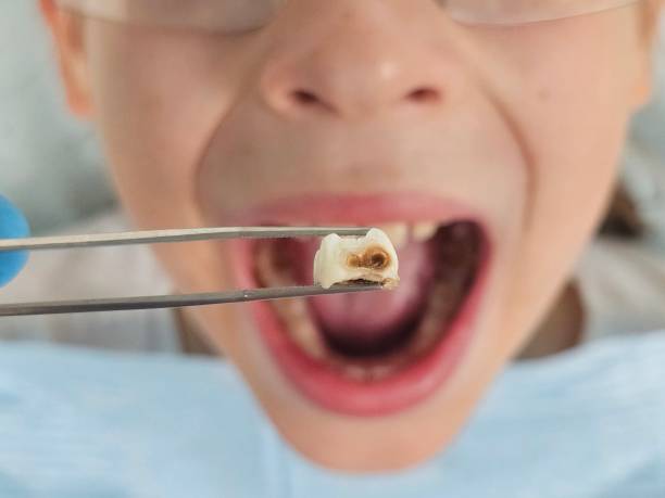 Best Urgent Dental Care  in Liberty City, TX